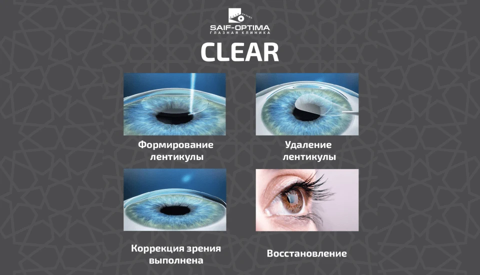 CLEAR теперь в Saif-Optima!